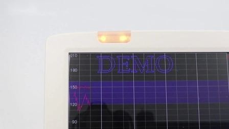 재생 기능을 갖춘 Meditech CE 및 ISO 승인 태아 심박수 모니터